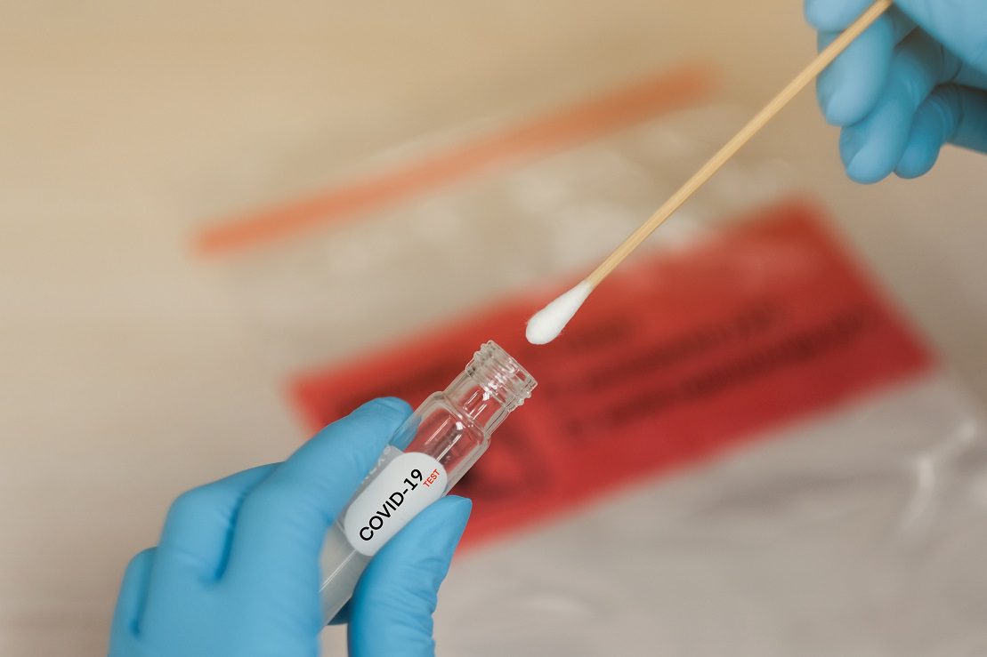 Serra oferece serviço de testagem rápida para Covid-19