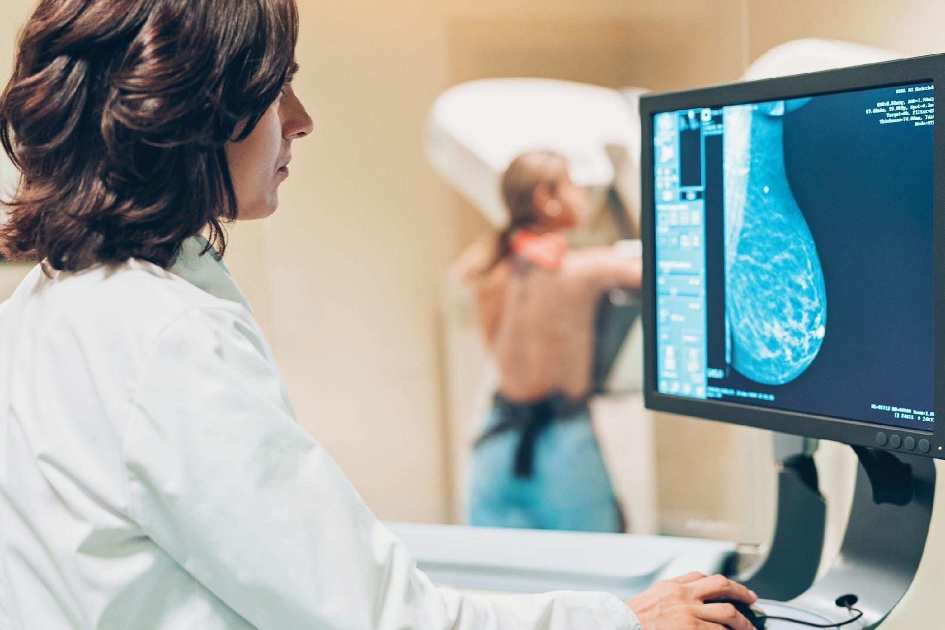 Serra registra mais de 1.283 mamografias agendadas pelo site