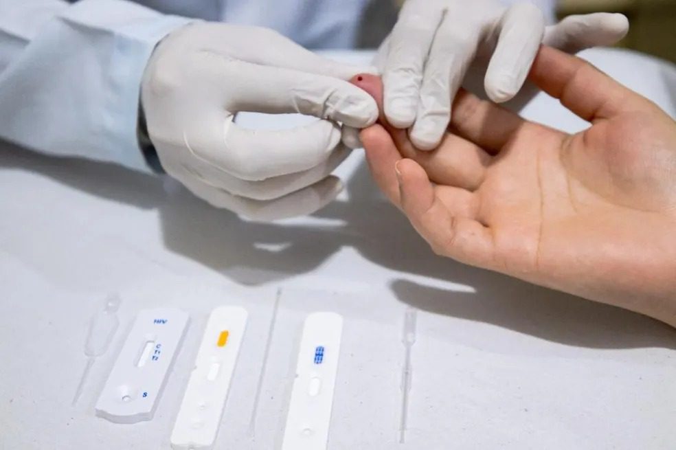 Testes de hepatites virais estarão disponíveis na Exposerra